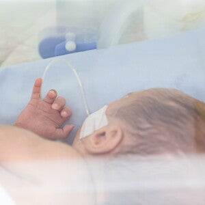 Parto prematuro, ¿qué es y cómo puedo evitarlo? ¿Cómo prevenir un parto prematuro?
