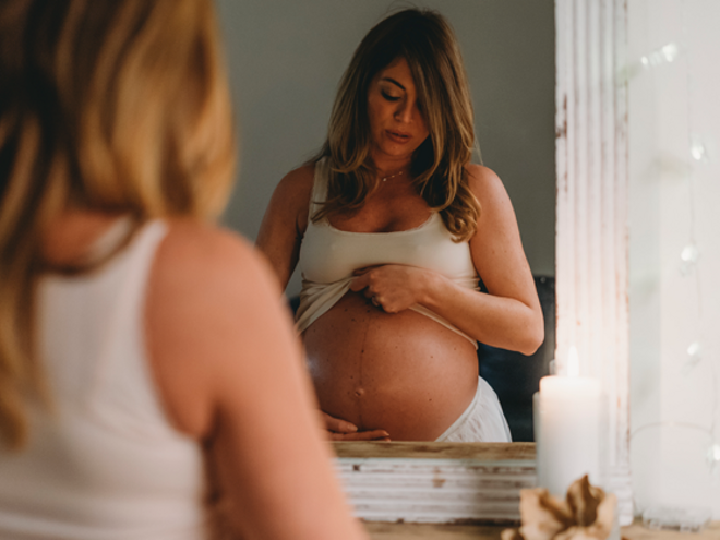 ¿Cómo prevenir las estrías durante el embarazo? como prevenir las estrías en el embarazo