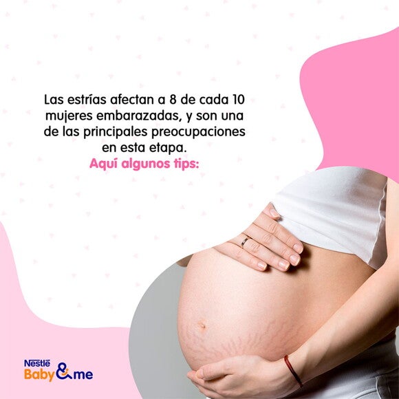 Las estrias afectan a 8 de cada 10 mujeres las estrias afectan a 8 de cada 10 mujeres