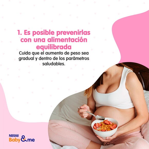 Alimentación equilibrada para prevenir las estrías alimentación equilibrada para prevenir las estrías